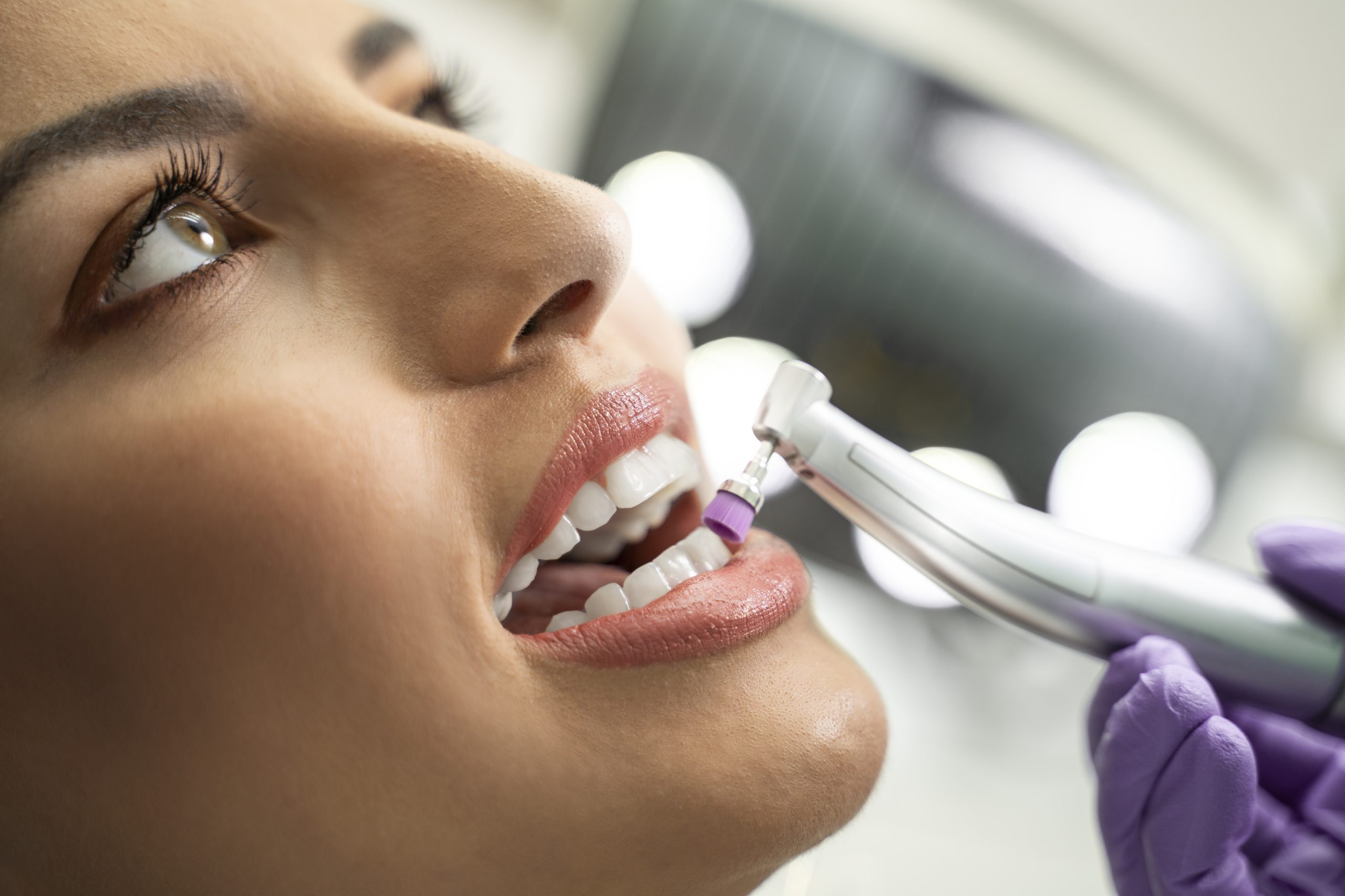 Preventative Dental Treatments Align Dental CentreAbbotsford